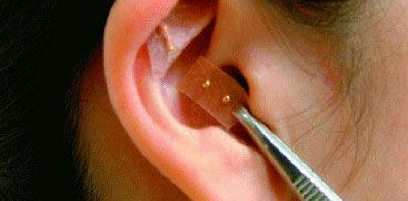 O que significa o ponto shenmen na orelha